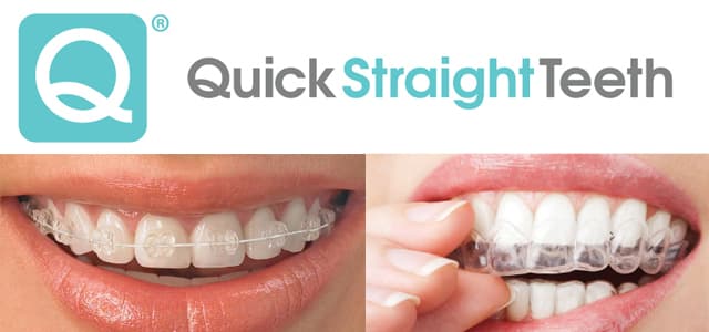 Quick Straight Teeth cosmetic braces